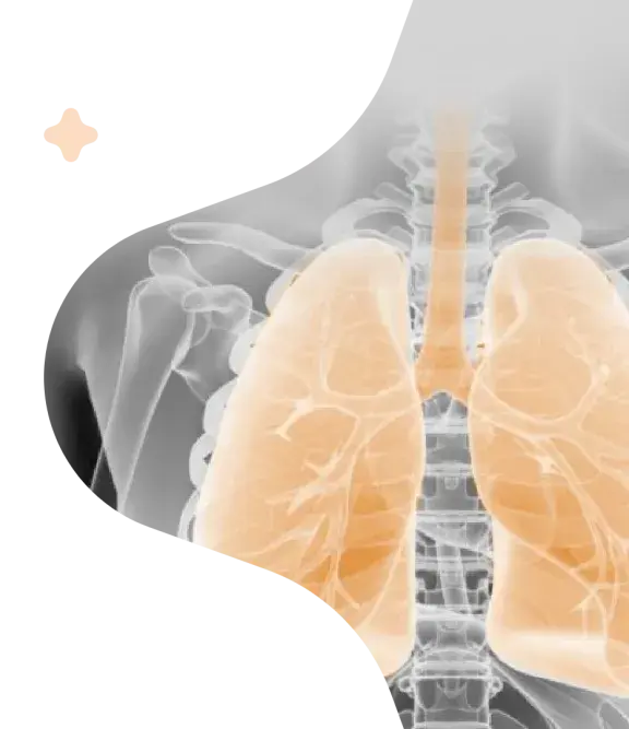 Redefining ventilation.